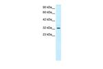 TAL1 Antibody in Western Blot (WB)