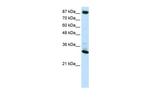 CTCF Antibody in Western Blot (WB)