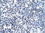 GCM1 Antibody in Immunohistochemistry (IHC)