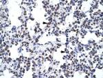 GCM1 Antibody in Immunohistochemistry (IHC)