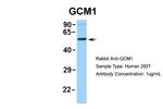 GCM1 Antibody in Western Blot (WB)