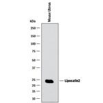 NGAL Antibody in Western Blot (WB)