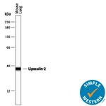 NGAL Antibody in Western Blot (WB)