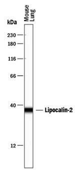 NGAL Antibody in Western Blot (WB)