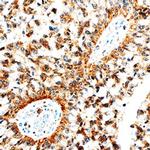 betacellulin Antibody in Immunohistochemistry (Paraffin) (IHC (P))