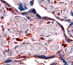 IGFBP4 Antibody in Immunohistochemistry (Paraffin) (IHC (P))