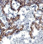 DLL4 Antibody in Immunohistochemistry (Paraffin) (IHC (P))