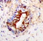 IL13RA2 Antibody in Immunohistochemistry (Paraffin) (IHC (P))