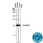 IL13RA2 Antibody in Western Blot (WB)