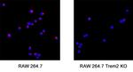 TREM2 Antibody in Immunocytochemistry (ICC/IF)