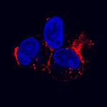 LDLR Antibody in Immunocytochemistry (ICC/IF)