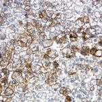 LDLR Antibody in Immunohistochemistry (Paraffin) (IHC (P))