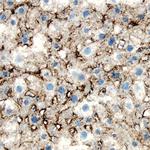 LDLR Antibody in Immunohistochemistry (Frozen) (IHC (F))