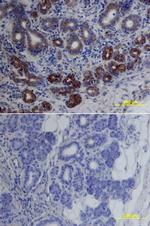 cIAP1 Antibody in Immunohistochemistry (Paraffin) (IHC (P))