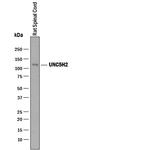 UNC5B Antibody in Western Blot (WB)