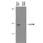 IL17RB Antibody in Western Blot (WB)