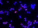 CD83 Antibody in Immunocytochemistry (ICC/IF)