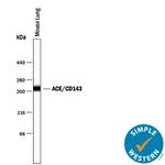 ACE Antibody in Western Blot (WB)