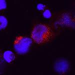 IL-28A Antibody in Immunocytochemistry (ICC/IF)