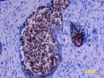 Kallikrein 11 Antibody in Immunohistochemistry (Paraffin) (IHC (P))