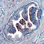 NOV Antibody in Immunohistochemistry (Paraffin) (IHC (P))