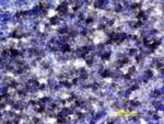 IL-6 Receptor Antibody in Immunohistochemistry (Frozen) (IHC (F))