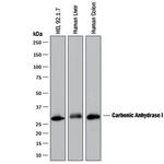 Carbonic Anhydrase I Antibody in Western Blot (WB)