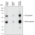 LGMN Antibody in Western Blot (WB)