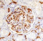 IL17RD Antibody in Immunohistochemistry (Paraffin) (IHC (P))