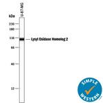 LOXL2 Antibody in Western Blot (WB)