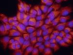 S100A8 Antibody in Immunocytochemistry (ICC/IF)