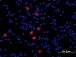 S100A8 Antibody in Immunocytochemistry (ICC/IF)