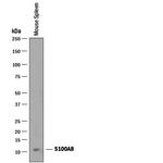 S100A8 Antibody in Western Blot (WB)