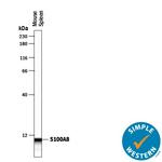 S100A8 Antibody in Western Blot (WB)