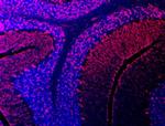 SEMA3E Antibody in Immunohistochemistry (Frozen) (IHC (F))