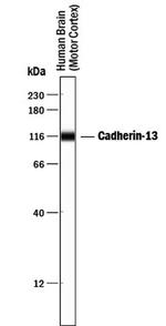 H-cadherin Antibody in Western Blot (WB)