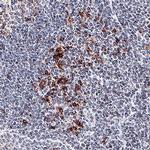 OX40 Antibody in Immunohistochemistry (Paraffin) (IHC (P))