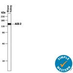 ACE2 Antibody in Western Blot (WB)