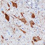 DOPA Decarboxylase Antibody in Immunohistochemistry (Paraffin) (IHC (P))