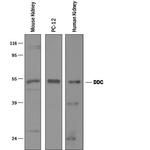 DOPA Decarboxylase Antibody in Western Blot (WB)