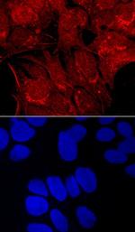 Carboxypeptidase E Antibody in Immunocytochemistry (ICC/IF)