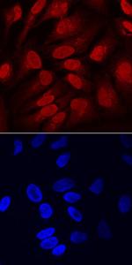 SOX11 Antibody in Immunocytochemistry (ICC/IF)