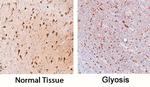 SOX11 Antibody in Immunohistochemistry (Paraffin) (IHC (P))