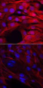 MYF5 Antibody in Immunocytochemistry (ICC/IF)