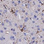 PLXNA3 Antibody in Immunohistochemistry (Paraffin) (IHC (P))