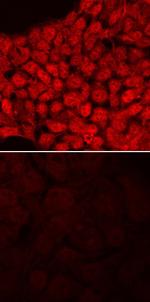 ID1 Antibody in Immunocytochemistry (ICC/IF)