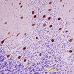 LRRC4 Antibody in Immunohistochemistry (Paraffin) (IHC (P))