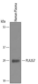 PLA2G7 Antibody in Western Blot (WB)