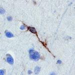 NLGN4X Antibody in Immunohistochemistry (Paraffin) (IHC (P))