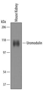 Uromodulin Antibody in Western Blot (WB)